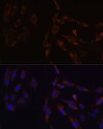 SUCLG2 Antibody in Immunocytochemistry (ICC/IF)