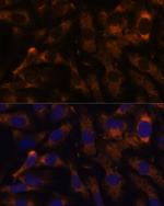 SUCLG2 Antibody in Immunocytochemistry (ICC/IF)