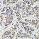 SUCLG2 Antibody in Immunohistochemistry (Paraffin) (IHC (P))