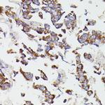 SUCLG2 Antibody in Immunohistochemistry (Paraffin) (IHC (P))