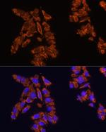 SIRP alpha Antibody in Immunocytochemistry (ICC/IF)