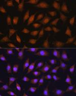 RPSA Antibody in Immunocytochemistry (ICC/IF)