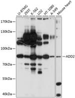 beta Adducin Antibody in Western Blot (WB)