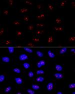 EBNA1BP2 Antibody in Immunocytochemistry (ICC/IF)