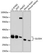 C17orf25 Antibody in Western Blot (WB)