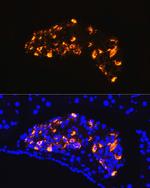 Somatostatin Antibody in Immunocytochemistry (ICC/IF)