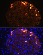 Somatostatin Antibody in Immunocytochemistry (ICC/IF)