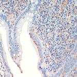 Somatostatin Antibody in Immunohistochemistry (Paraffin) (IHC (P))