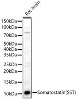 Somatostatin Antibody in Western Blot (WB)