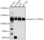 CAS Antibody in Western Blot (WB)