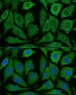 SARDH Antibody in Immunocytochemistry (ICC/IF)