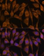 Ubiquilin 2 Antibody in Immunocytochemistry (ICC/IF)