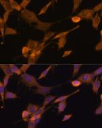 Ubiquilin 2 Antibody in Immunocytochemistry (ICC/IF)