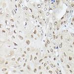 Ubiquilin 2 Antibody in Immunohistochemistry (Paraffin) (IHC (P))