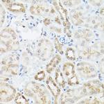 Ubiquilin 2 Antibody in Immunohistochemistry (Paraffin) (IHC (P))