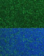 NOXA Antibody in Immunocytochemistry (ICC/IF)