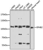 EphB2 Antibody in Western Blot (WB)