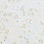 GIPR Antibody in Immunohistochemistry (Paraffin) (IHC (P))