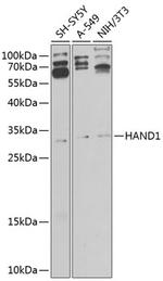 HAND1 Antibody in Western Blot (WB)