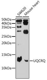 UQCRQ Antibody in Western Blot (WB)