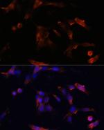 Aquaporin 5 Antibody in Immunocytochemistry (ICC/IF)