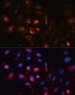 Aquaporin 5 Antibody in Immunocytochemistry (ICC/IF)