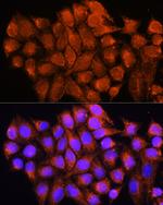 ATP5D Antibody in Immunocytochemistry (ICC/IF)