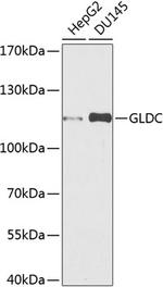 GLDC Antibody in Western Blot (WB)