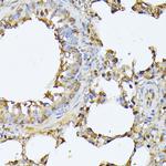 PSMB3 Antibody in Immunohistochemistry (Paraffin) (IHC (P))