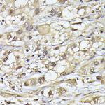 PSMB3 Antibody in Immunohistochemistry (Paraffin) (IHC (P))