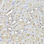 PSMB3 Antibody in Immunohistochemistry (Paraffin) (IHC (P))