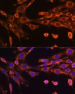 SUPV3L1 Antibody in Immunocytochemistry (ICC/IF)