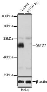 SETD7 Antibody