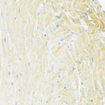 MNF1 Antibody in Immunohistochemistry (Paraffin) (IHC (P))