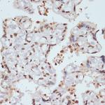 Phospho-Chk1 (Ser280) Antibody in Immunohistochemistry (Paraffin) (IHC (P))