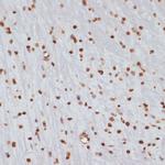 Phospho-Chk1 (Ser280) Antibody in Immunohistochemistry (Paraffin) (IHC (P))