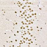 Phospho-CREB (Ser133) Antibody in Immunohistochemistry (Paraffin) (IHC (P))