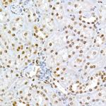 Phospho-Rb (Ser795) Antibody in Immunohistochemistry (Paraffin) (IHC (P))