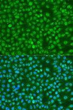 Phospho-BRCA1 (Ser1423) Antibody in Immunocytochemistry (ICC/IF)