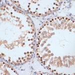 Phospho-BRCA1 (Ser1423) Antibody in Immunohistochemistry (Paraffin) (IHC (P))