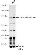 Phospho-STAT2 (Tyr690) Antibody in Western Blot (WB)