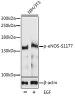 Phospho-eNOS (Ser1177) Antibody in Western Blot (WB)