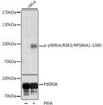 Phospho-RSK1 (Ser380) Antibody in Western Blot (WB)