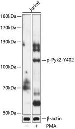 Phospho-PYK2 (Tyr402) Antibody in Western Blot (WB)