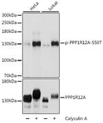 Phospho-MYPT1 (Ser507) Antibody in Western Blot (WB)