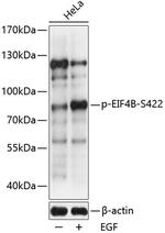 Phospho-eIF4B (Ser422) Antibody in Western Blot (WB)