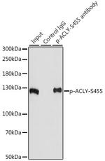 Phospho-ATP Citrate Lyase (Ser455) Antibody in Immunoprecipitation (IP)