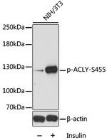 Phospho-ATP Citrate Lyase (Ser455) Antibody in Western Blot (WB)