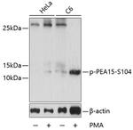 Phospho-PEA15 (Ser104) Antibody in Western Blot (WB)