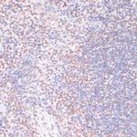 Phospho-MSK1 (Ser376) Antibody in Immunohistochemistry (Paraffin) (IHC (P))